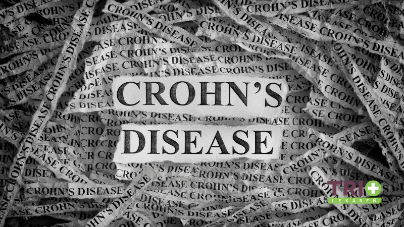 Nápis 'Crohn's Disease' na pozadí s opakujúcimi sa textami, znázorňujúci Crohnovu chorobu.