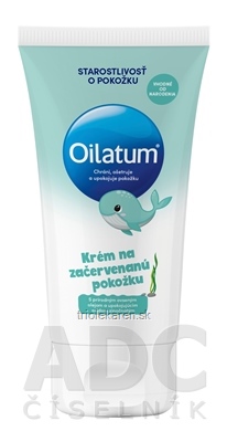 Oilatum krém na začervenanú pokožku 100 ml