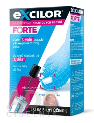 Excilor FORTE lak na liečbu plesňových infekcií nechtov 1x30 ml